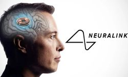 Neuralink, ikinci hastasına başarıyla beyin çipi yerleştirdi