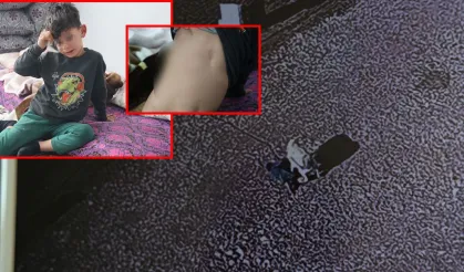 Ekmek vermek için yanına gittiği köpeğin saldırısına uğrayan 5 yaşındaki çocuğun korku dolu anları