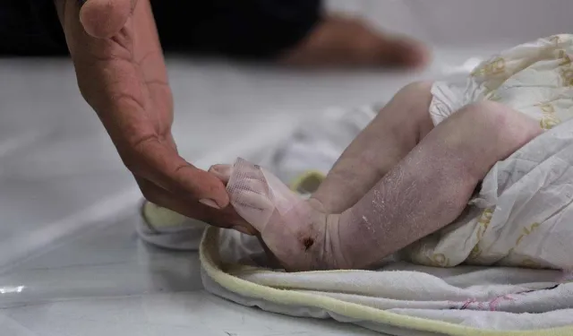 Gazze’de soğuk ve abluka bebekleri öldürüyor